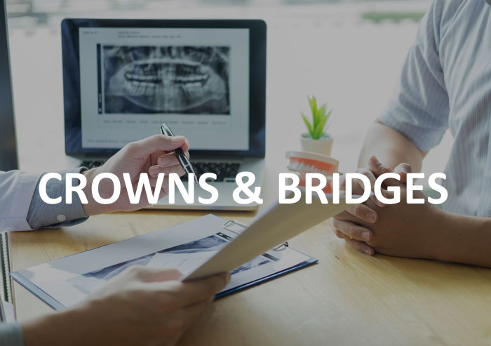 Crowns-and-Bridges-dentist-frankston