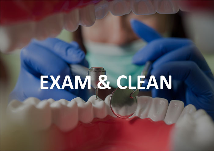 Exam-and-clean-dentist-frankston