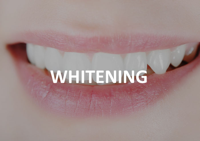 whitening-dentist-frankston